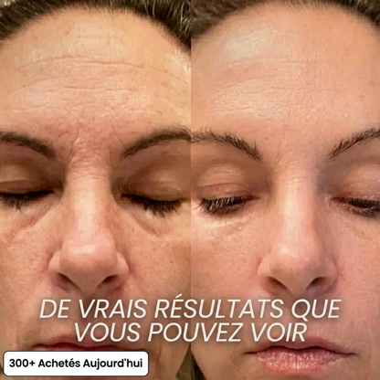 Stick Repulpant Bio-Collagène PDRN