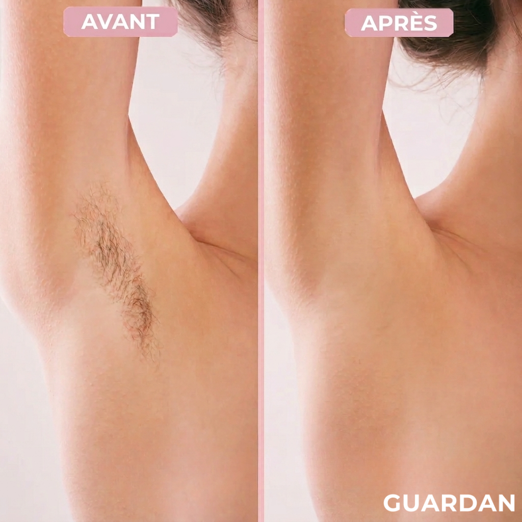 Guardan™ rasoir corporel 2-en-1